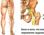 Дисфункция сухожилия задней большеберцовой мышцы