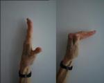 Упражнения для кистей рук и пальцев Гимнастика большого пальца руки после травмы